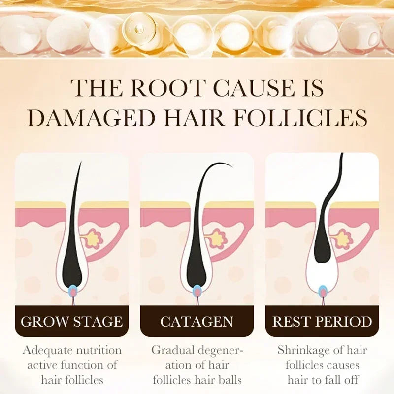 Biotin Hair Growth Oil - Scalp Treatment & Hair Loss Serum