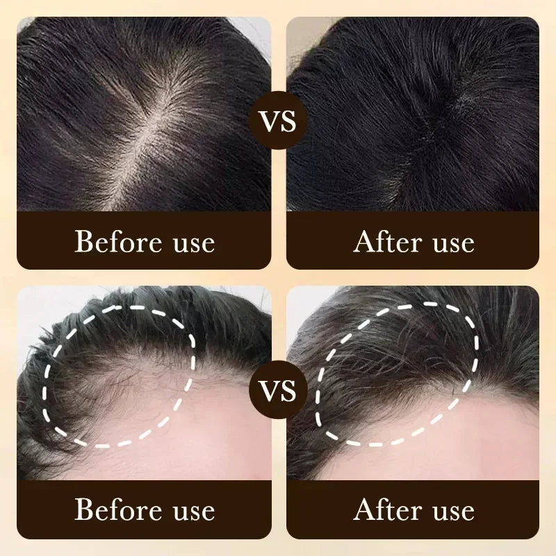Biotin Hair Growth Oil - Scalp Treatment & Hair Loss Serum