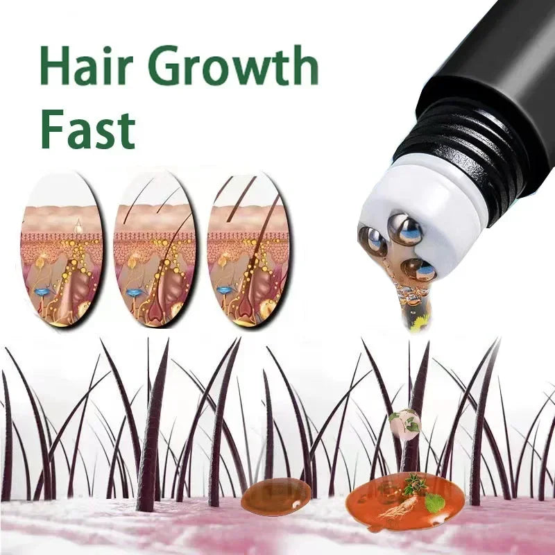 Biotin Hair Growth Oil - Scalp Treatment & Hair Loss Serum